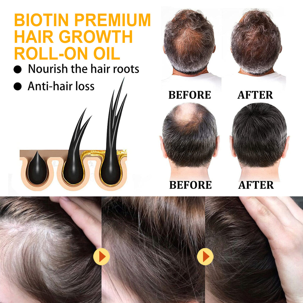 Biotin Hair Care Ball Gentle Ingredients Nourish And Moisturize Hair, Smooth And Glossy Hair Care Ball