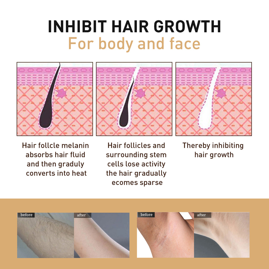 Hair Removal Spray, Mild Non-Irritating Dry And Cool Whole Body Hair Removal And Hair Suppression Spray