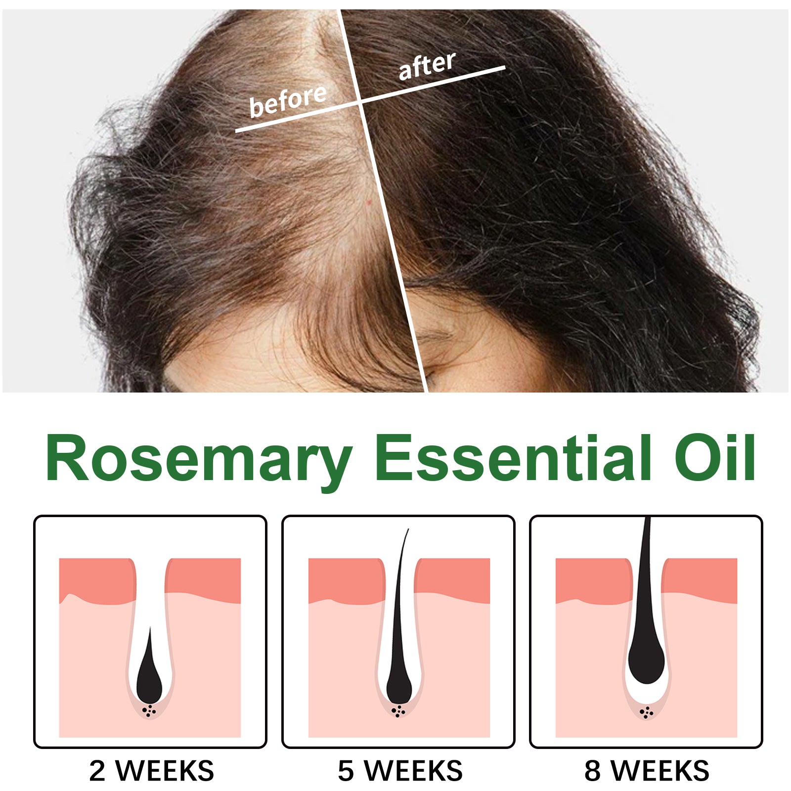 Rosemary Hair Care Essential Oil Repair Split End Dry Hair, Nourish And Smooth Hair Care Oil