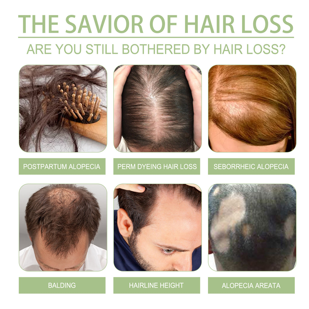 Herbal Hair Care Oil Gently Nourishes Scalp, Strengthens Hair, Cleanses Scalp, Softens Hair Care Oil