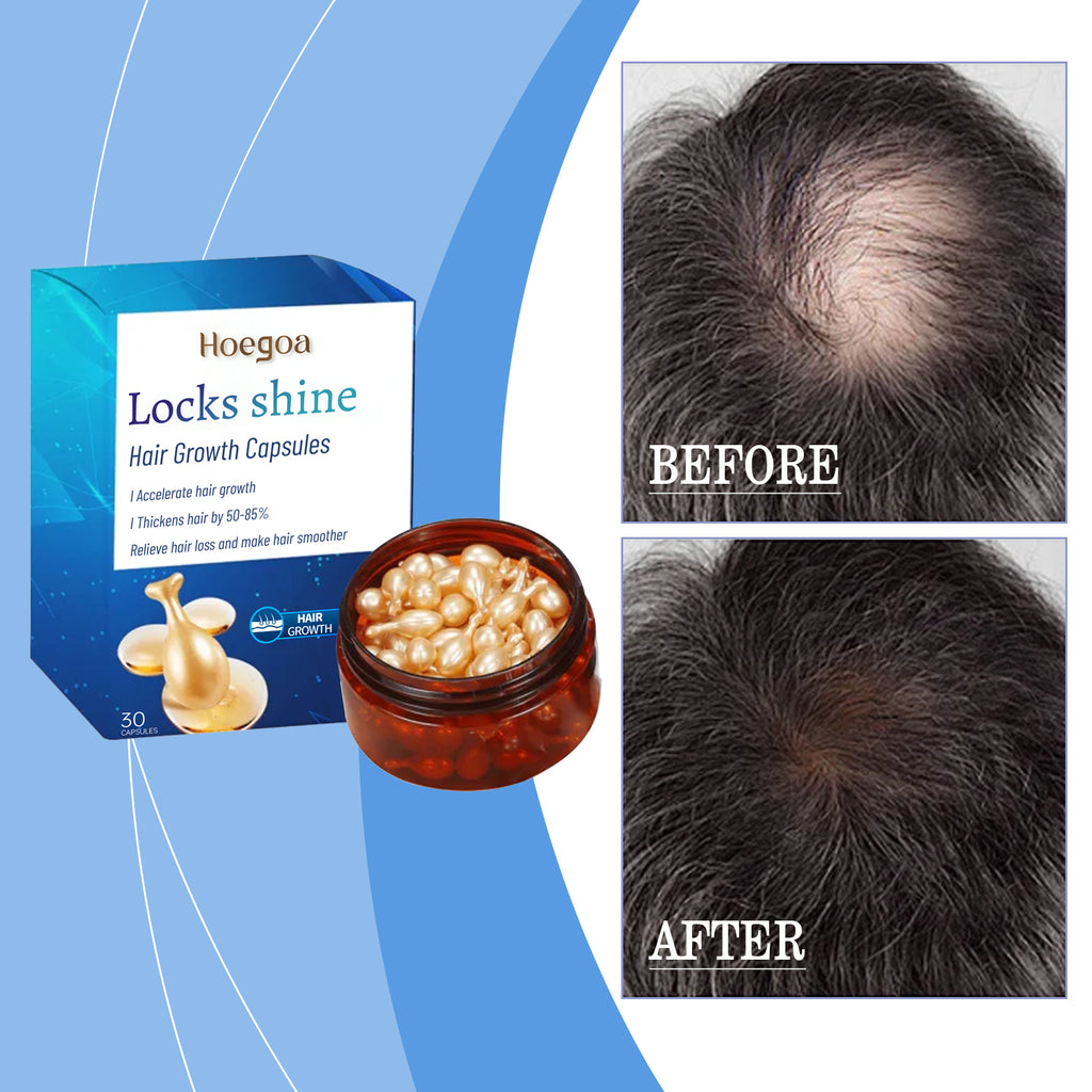 Intensive Hair Care Capsule, Scalp Repair Essential Oil Smoothing Hair Care Essence Leave-In Hair Care Capsule