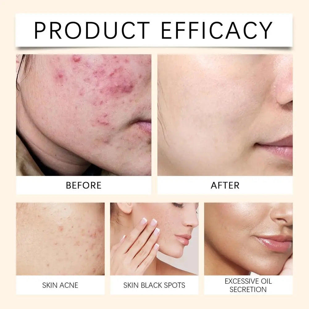 Moisturizing Soothing Essence Spray Deeply Hydrates Brightening Revitalize Dull Skin Nourishes Dry Skin Daily Skin Care